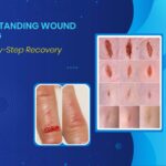 Wound Healing Stages & Recovery: 5 Powerful Factors to Know