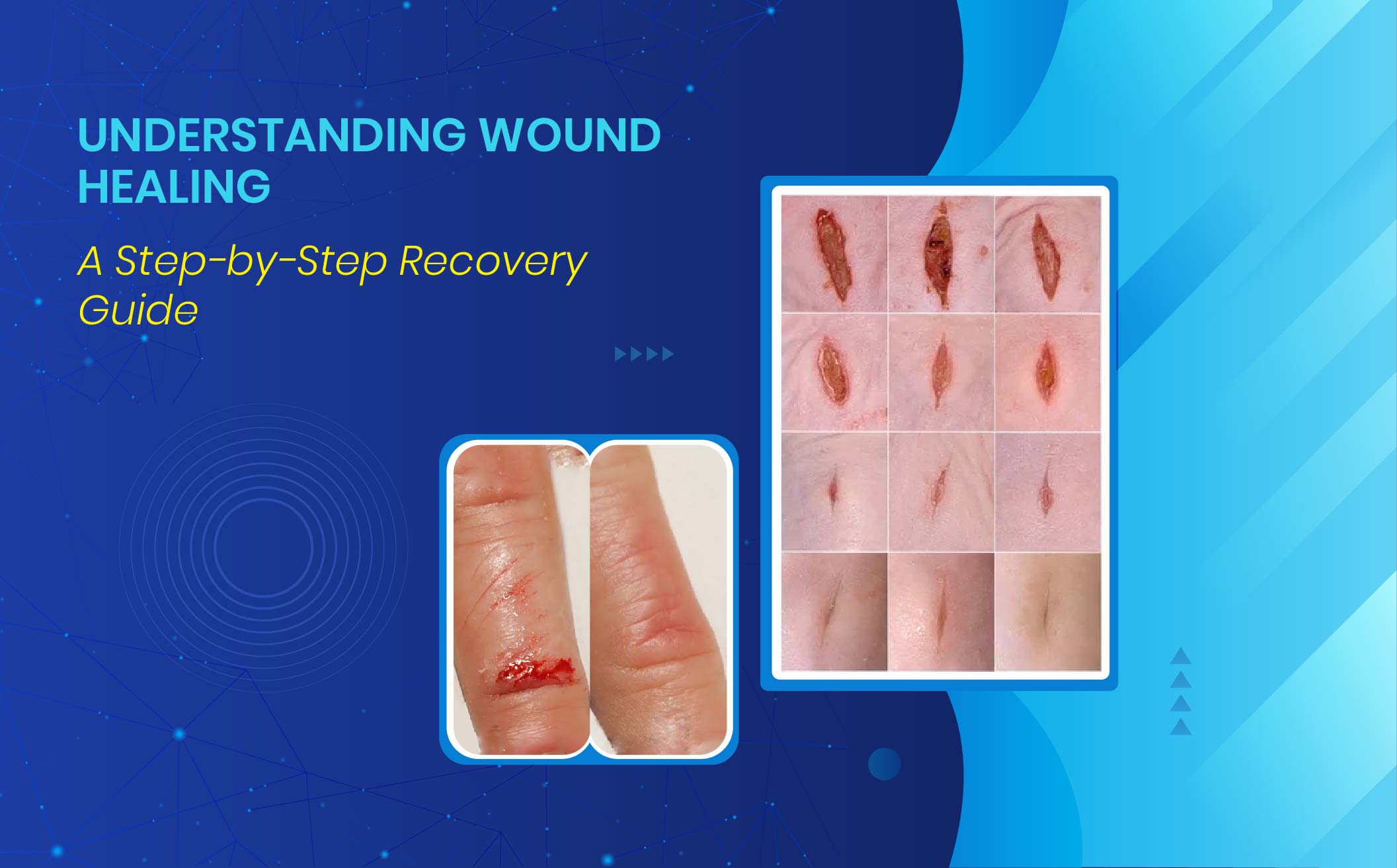 Wound Healing Stages & Recovery: 5 Powerful Factors to Know