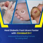 Diabetic Foot Ulcers: A Guide to Prevention  and Treatment