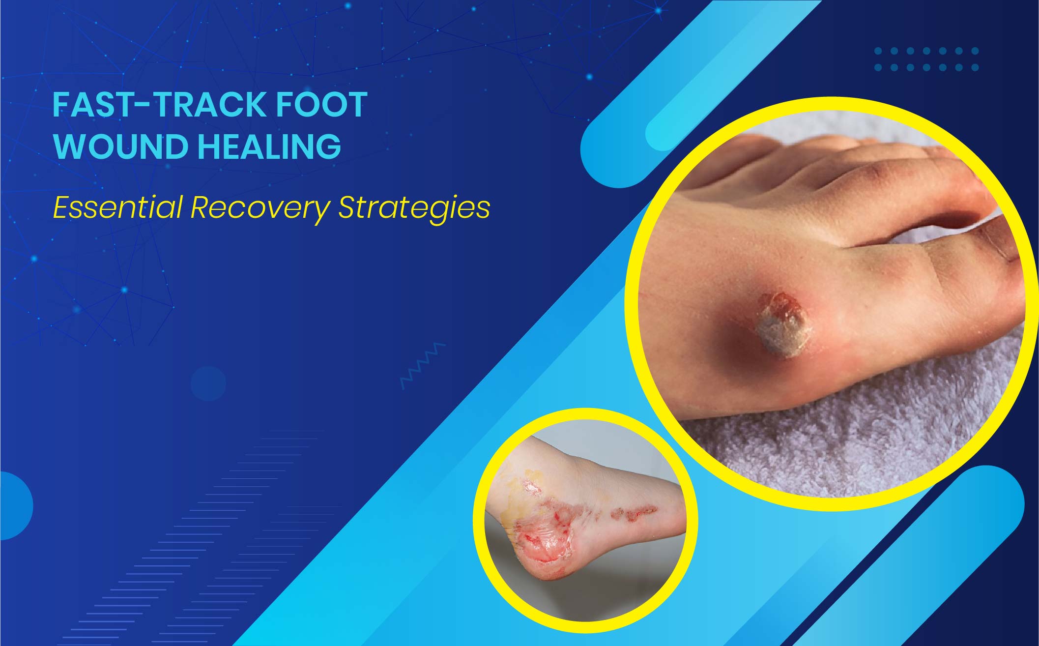 Foot Injuries vs. Foot Wounds: 7 Key Differences and How to Treat Them Effectively