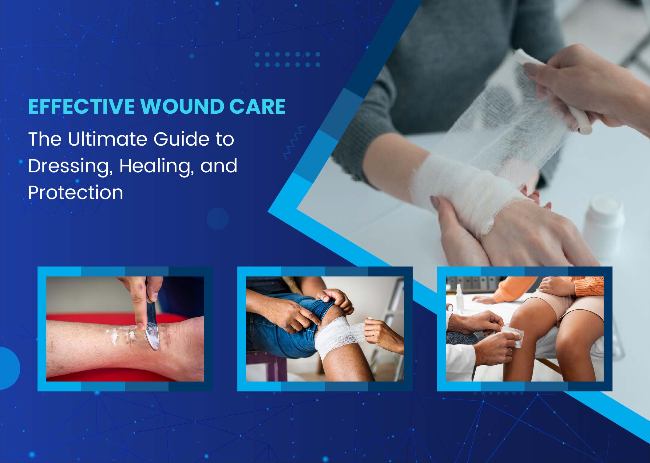 wound dressing