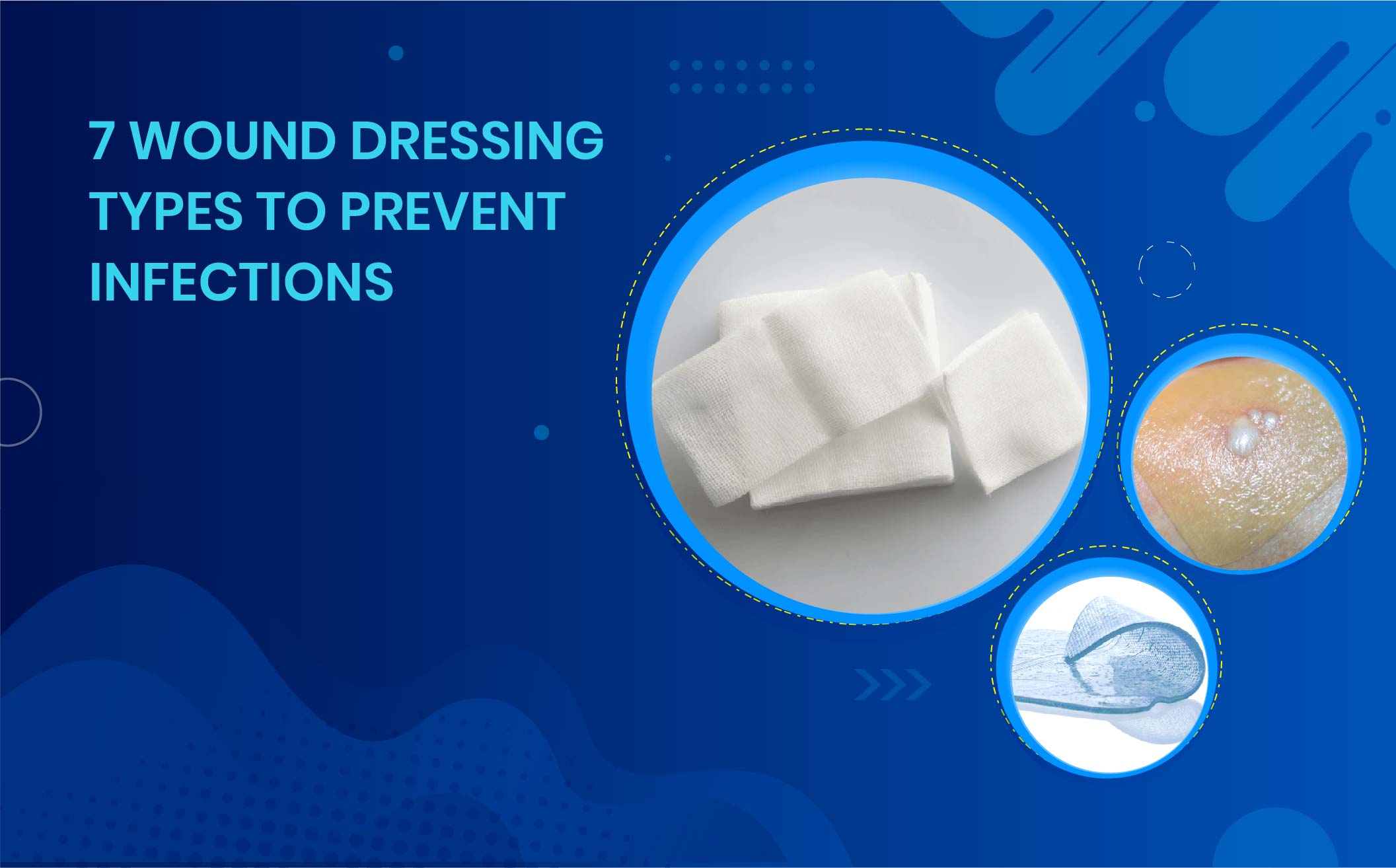 7 Essential Wound Dressing Types to Prevent Infections”