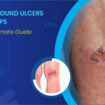 wound ulcers